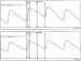 Abb. 4a: Raynaud-Phnomen