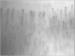 Abb. 9: Raynaud-Phnomen