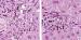 Aktuelles Bild - Abb. 1a-b: Cholestase