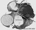 Fig. 1: Koronarangiographie - Multislice CT