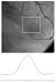 Fig. 2: R. interventricularis anterior - Stenose