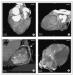 Fig. 3a-d: MDCT-Computertomographie