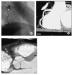 Fig. 5a-c: MDCT-Computertomographie