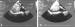 Fig. 3A-B: Atriales Myxom