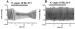 Fig. 1A-B: Angiotensin II - Vagusstimulation