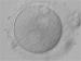 Abb. 3: Zygote - Vorkernmuster