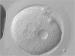 Abb. 5: Zygote - Vorkernmuster