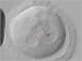 Abb. 6: Zygote - Vorkernmuster