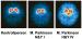 Abb. 2: Morbus Parkinson - SPECT