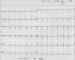 Aktuelles Bild - Abb. 4: EKG - Sinusrhythmus