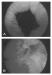 Abb. 1a-b: Bulking agents