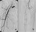 Abb. 2: Arteria femoralis superficialis
