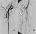 Abb. 3: Arteria femoralis superficialis
