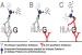 Abb. 3: sHLG-G-Fangantikrper-ELISA-Aufbau