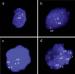 Abb. 3a-d: FISH-Analyse - AR-Gen
