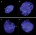 Abb. 4a-d: FISH-Analyse - Zentrometer - Chromosom