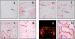 Abb. 2: GLUT1 - GLUT3 - Immunhistochemische Frbung