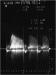 Abb. 2: Echokardiographie - Prothesenffnung