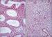 Abb. 4: Endometrium - Histologie