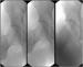 Aktuelles Bild - Abb. 5: Stengraft