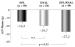 Abb. 2: Eplerenon - Linkventrikulre Masse