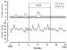 Abb. 2: Amenorrh - LH - FSH-