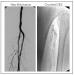 Abb. 5: Angiogramm