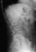 Aktuelles Bild - Abb. 3: Osteoporose - Radiologie