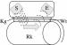 Abb. 2: Densitometrie - Quantitativer Ultraschall