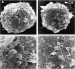 Abb. 7a-b: Spermatozoon - Blastozyste