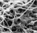 Abb. 6: Spermatozoon - Zona pellucida