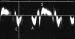 Abb. 5: Gewebedoppler
