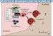 Abb. 3: Rheumatoide Arthritis - Knochenerosion