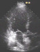 Abb. 9: Echokontrolle