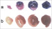 Abb. 3: TTC-stained heart