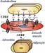 Abb. 4: Perivaskulres Fett -