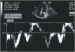 Abb. 7: Gewebedoppler
