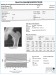 Abb. 5: DXA-Scan - Femur