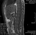 Abb. 7: MRI - LWS
