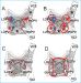 Abb. 1: Katheterablation