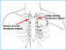 Abb. 2: Arteria thoracica interna
