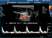 Abb. 4: Arteria thoracica interna