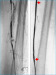 Abb. 1: Arteria femoralis superficialis