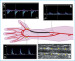 Aktuelles Bild - Abb. 2a-d: Pathologisches Flumuster
