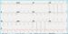 Abb. 1: EKG