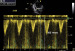 Abb. 10: Aortales elektromechanisches Delay