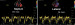 Abb. 14: PW-Gewebedoppler (Septum/lateral)