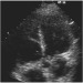 Abb. 3: Transthorakales Echo