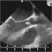 Abb. 8: Transthorakales Echo