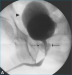 Abb. 3: Cystourethrogram